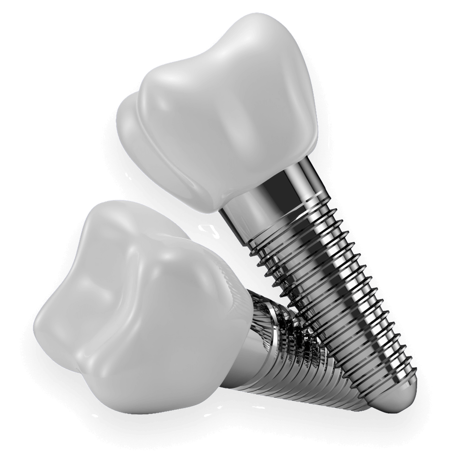 Dental implants: Two crowns and posts.